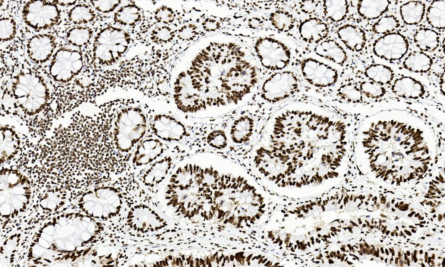 14 - ARID1A AD80511