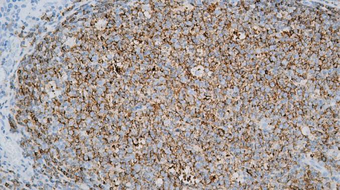 14 - CD22 AD80516