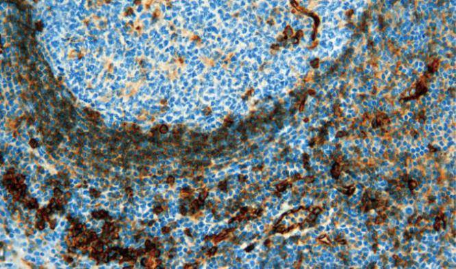 14 - CD31 antibody AD80517