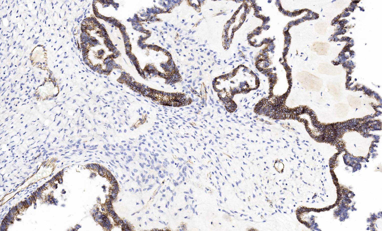 14 - N-Cadherin AD80521