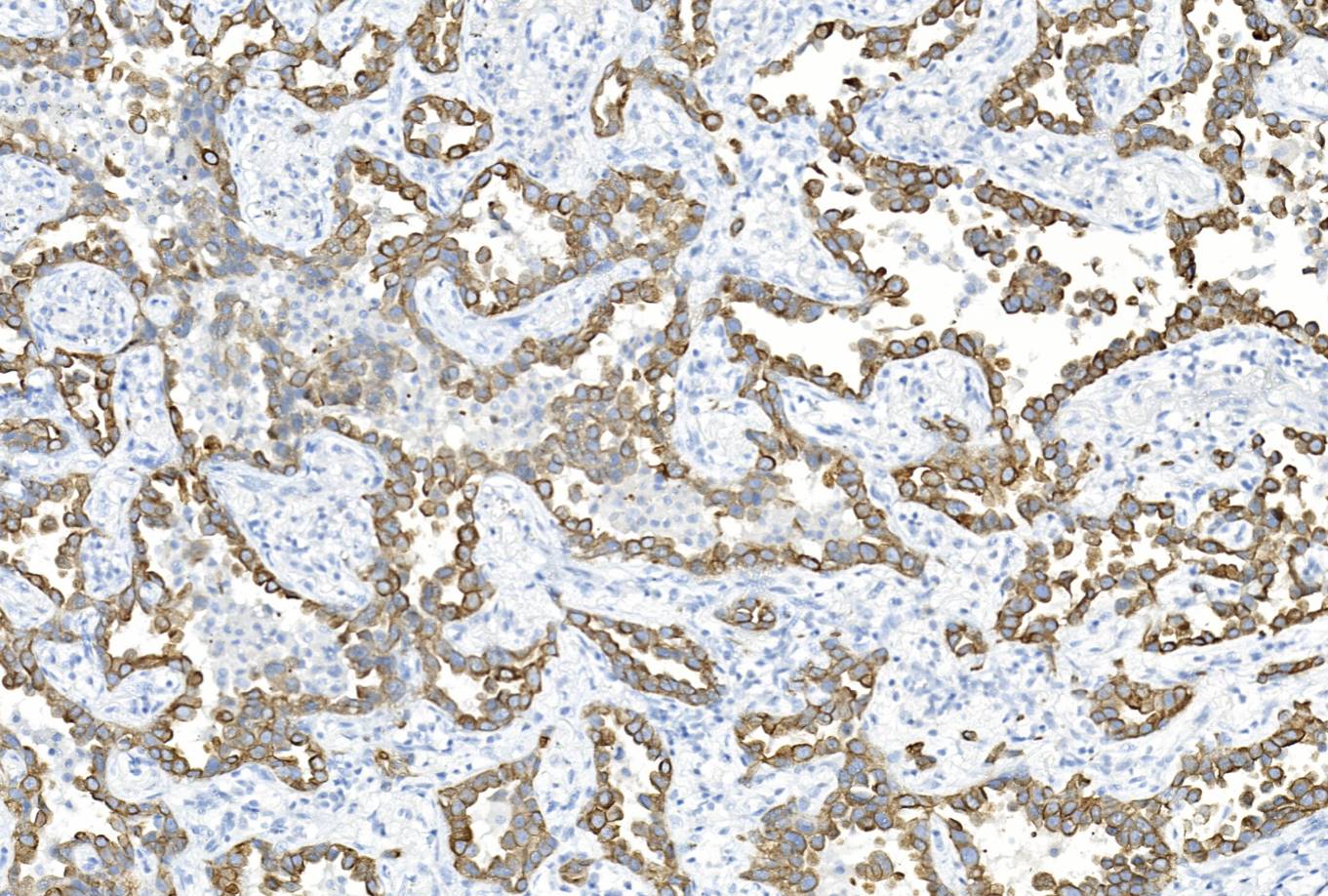 14 - CK18 antibody AD80526