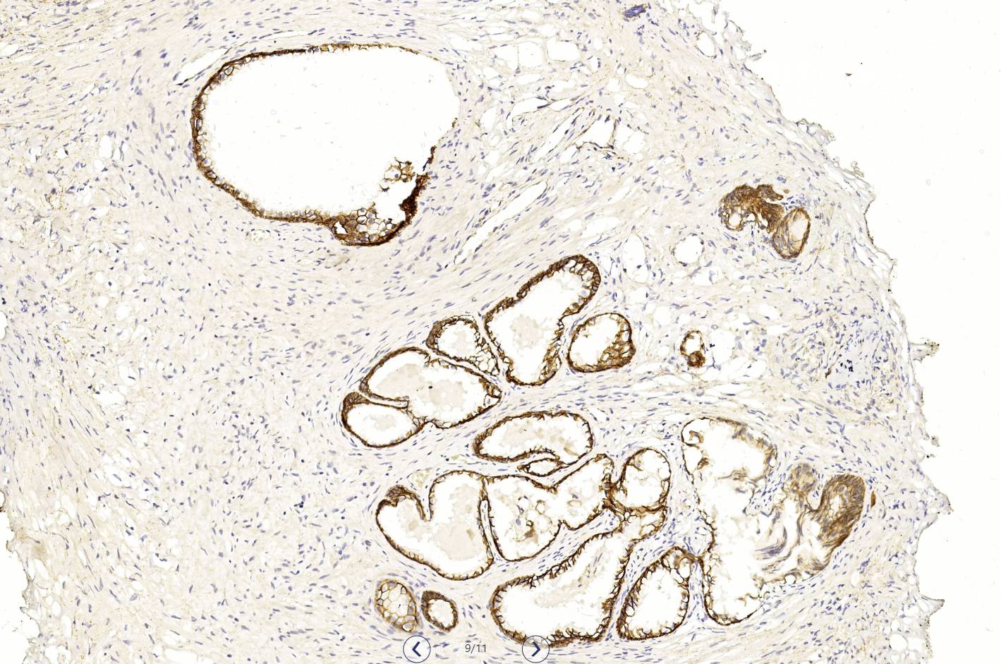 14 - CK18 antibody AD80526