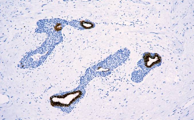 14 - CK18 antibody AD80526
