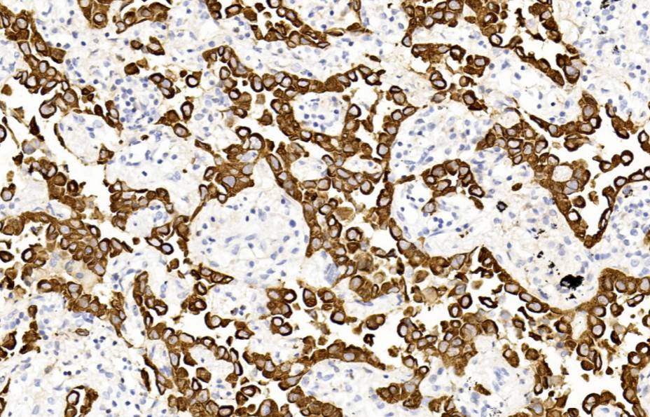 14 - CK19 antibody AD80527