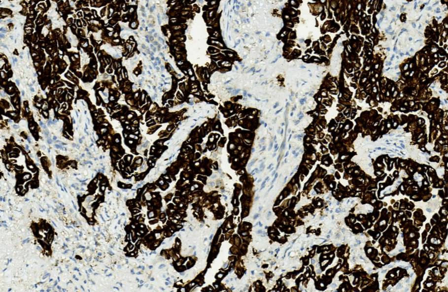 14 - CK19 antibody AD80527