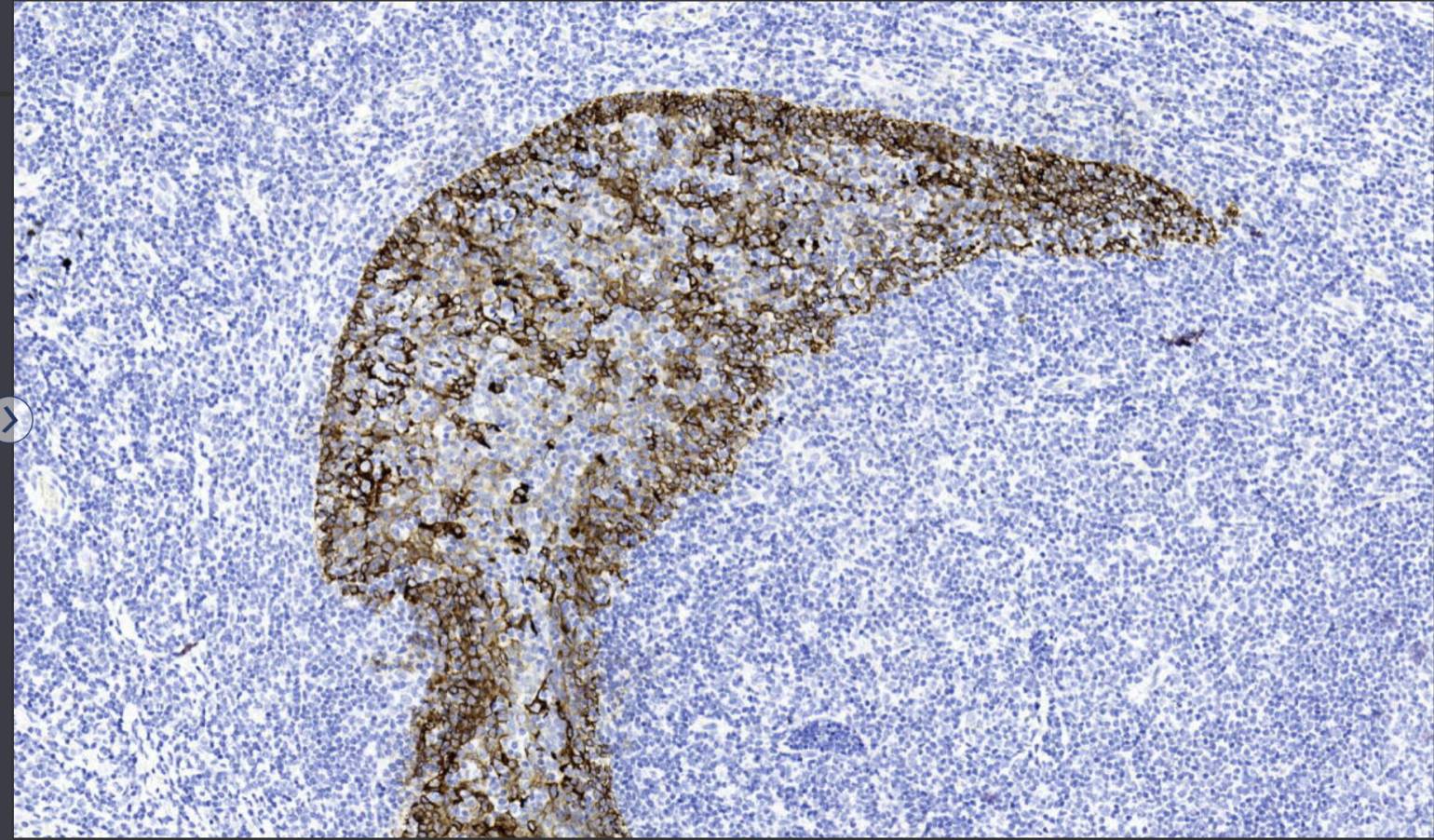 14 - CK19 antibody AD80527