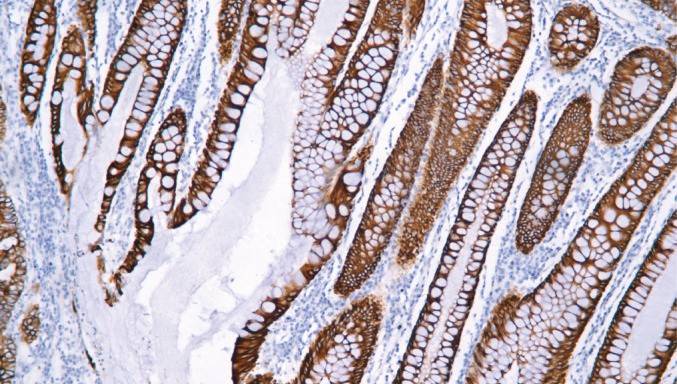 14 - CK19 antibody AD80527