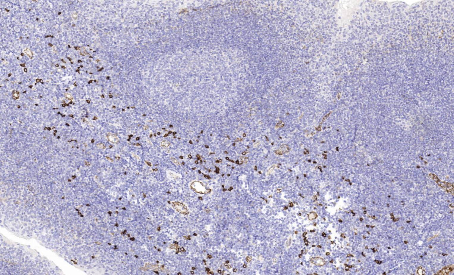14 - CD123 AD80534