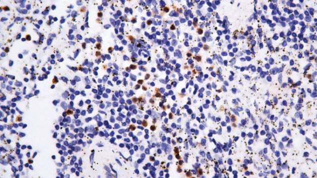 14 - Granzyme B antibody AD80535