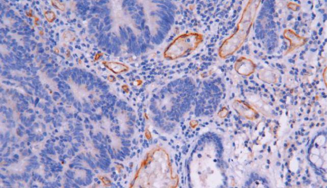 14 - CD105 antibody  AD80536