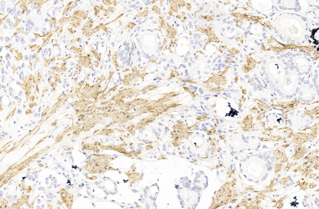 14 - Calponin AD80537