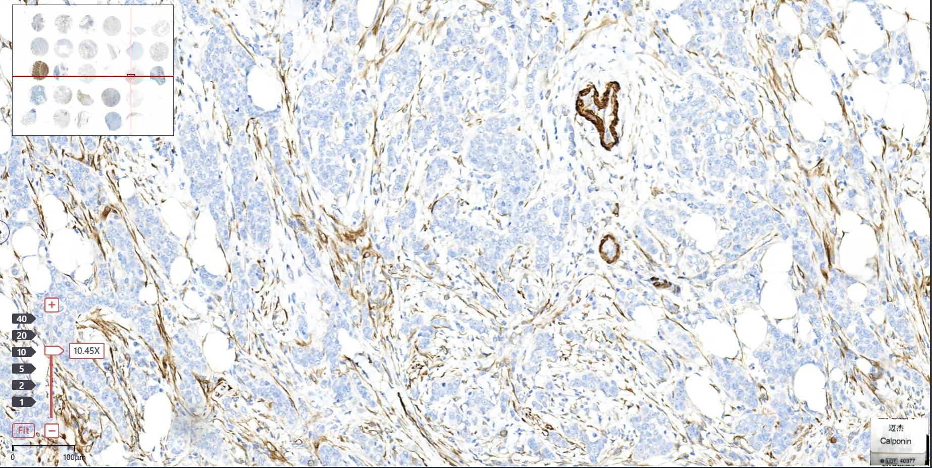14 - Calponin AD80537