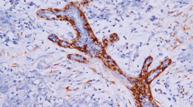 14 - Calponin AD80537