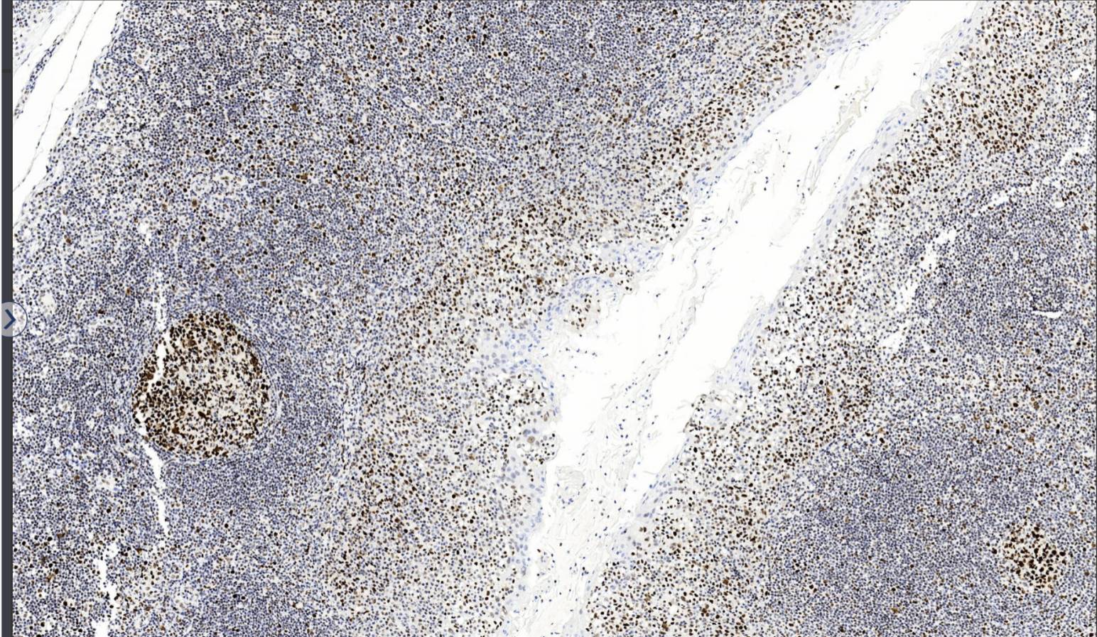 14 - MSH6 antibody AD80540