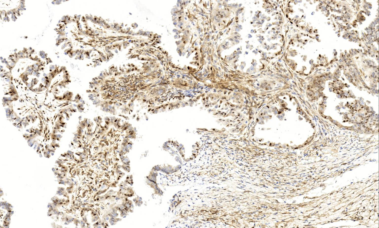 14 - CDK4 AD80542