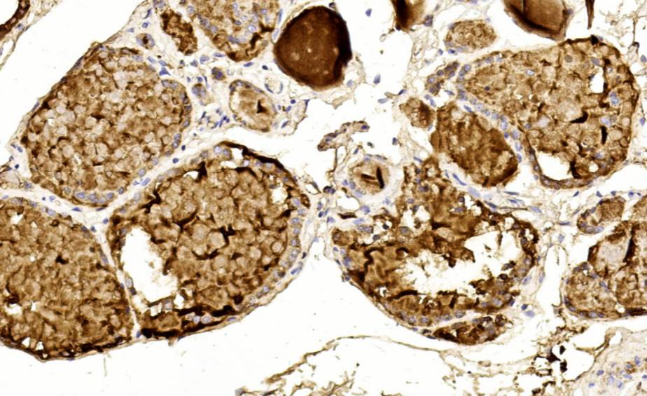 14 - THY AD80543