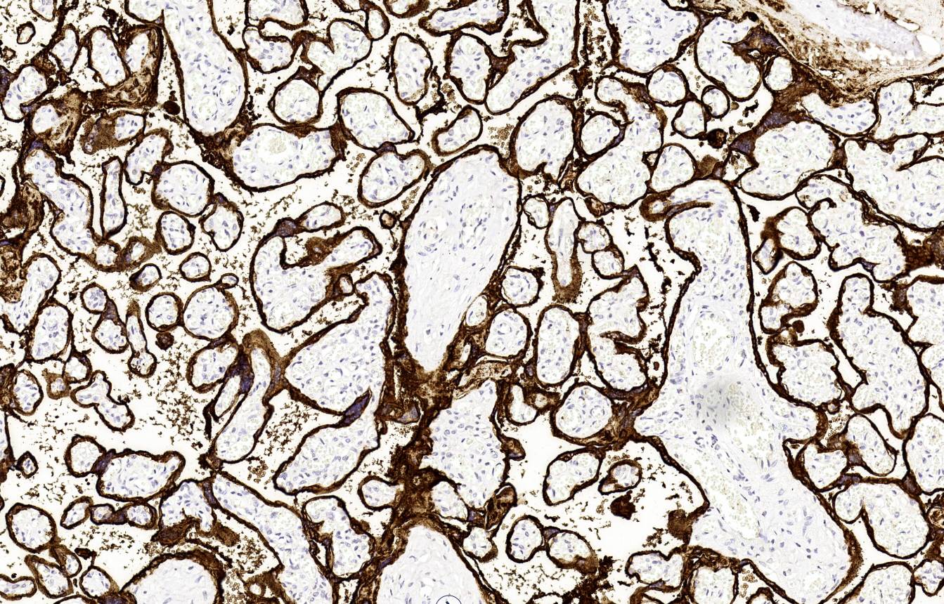 14 - PLAP antibody AD80544