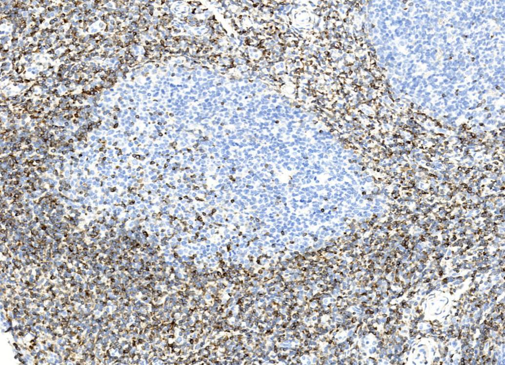 14 - bcl-2 AD80545