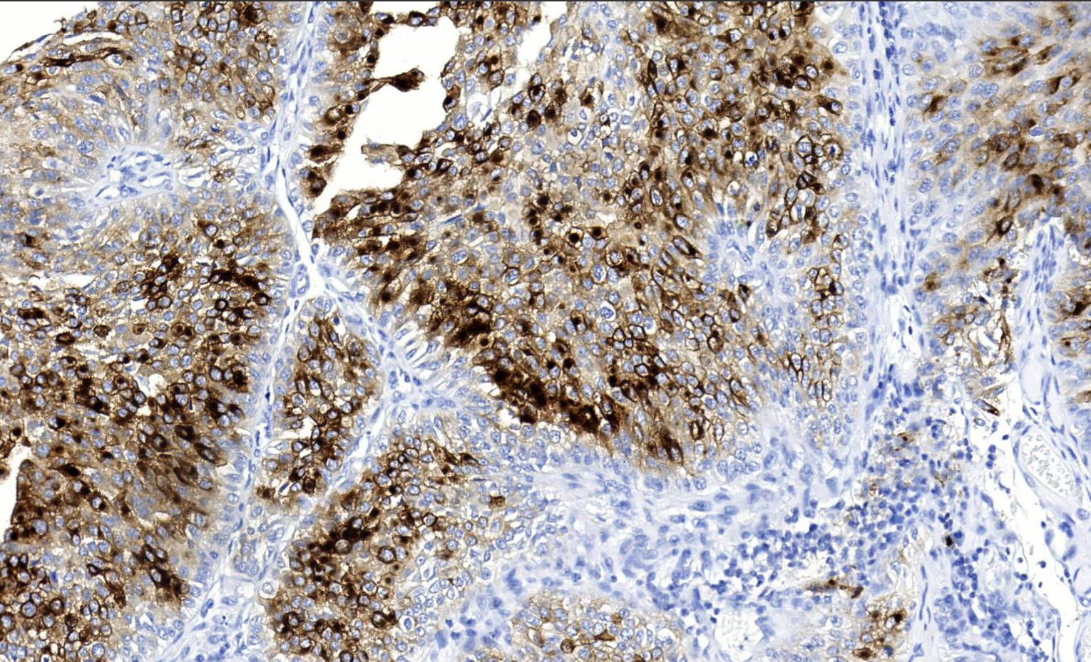 14 - Uroplakin Ⅲ AD80546