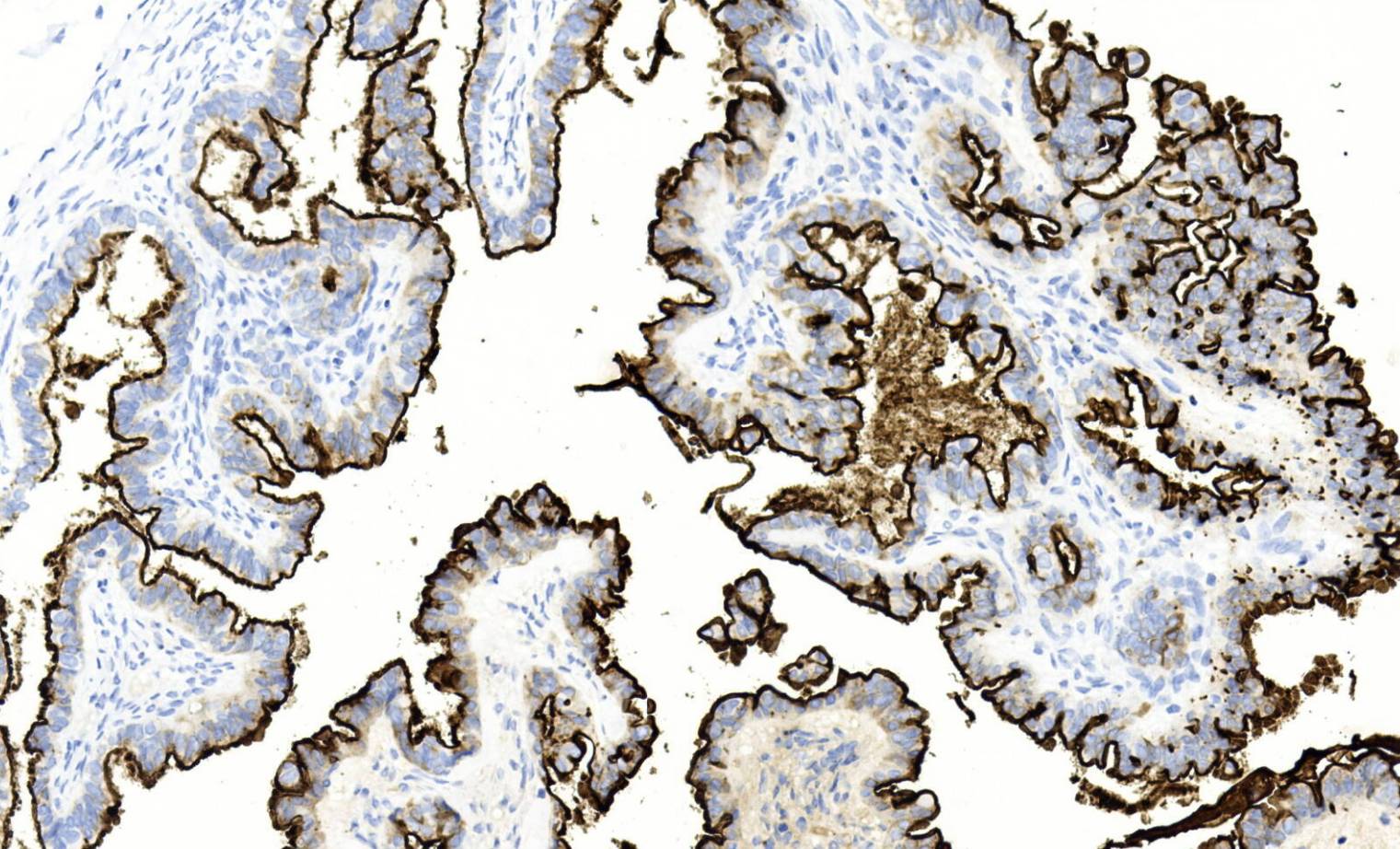 14 - Mesothelin AD80548