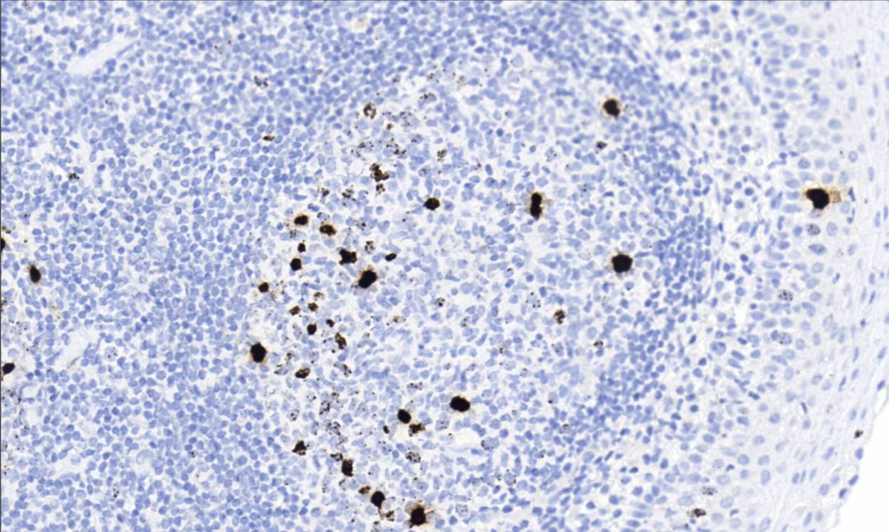 14 - PHH3 AD80553