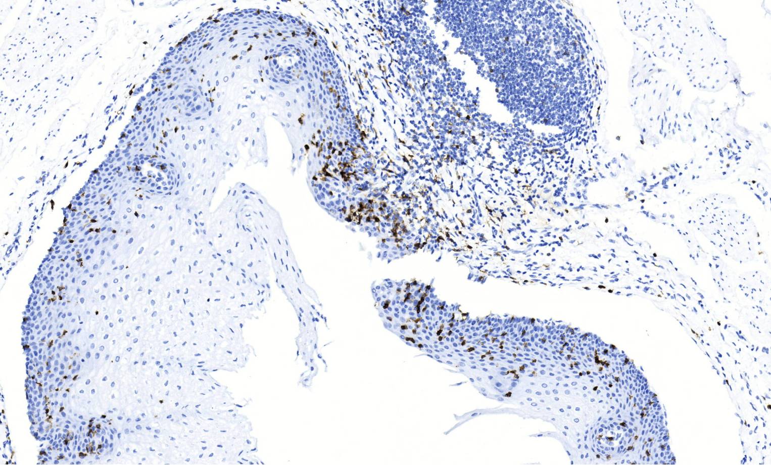 14 - CD103 AD80554