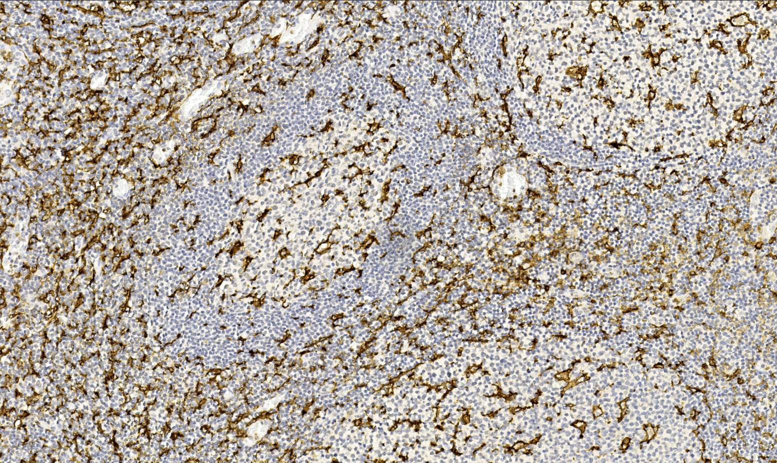 14 - CD11c AD80555