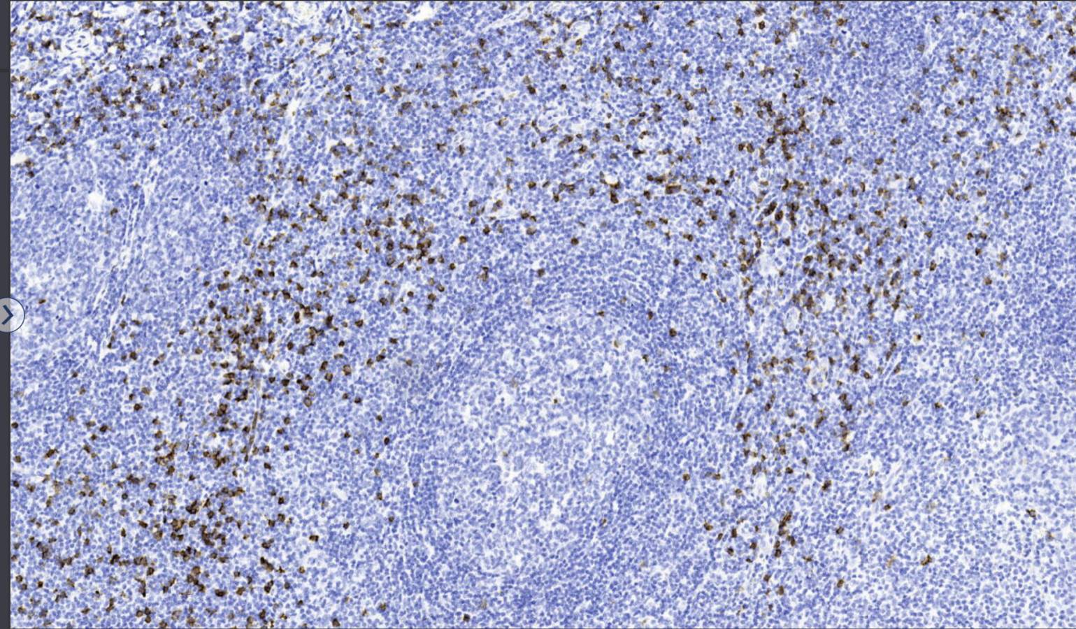 14 - Anti-CD8 antibody AD80577