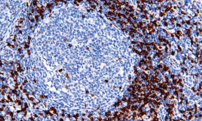 14 - Anti-CD8 antibody AD80577