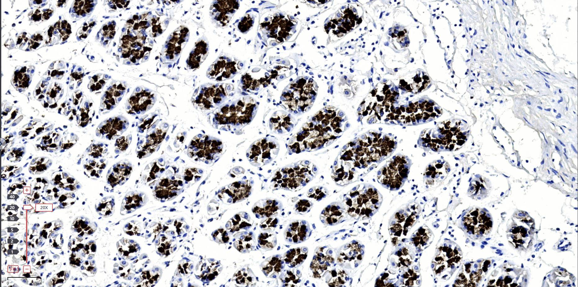 14 - Pepsinogen I AD80581