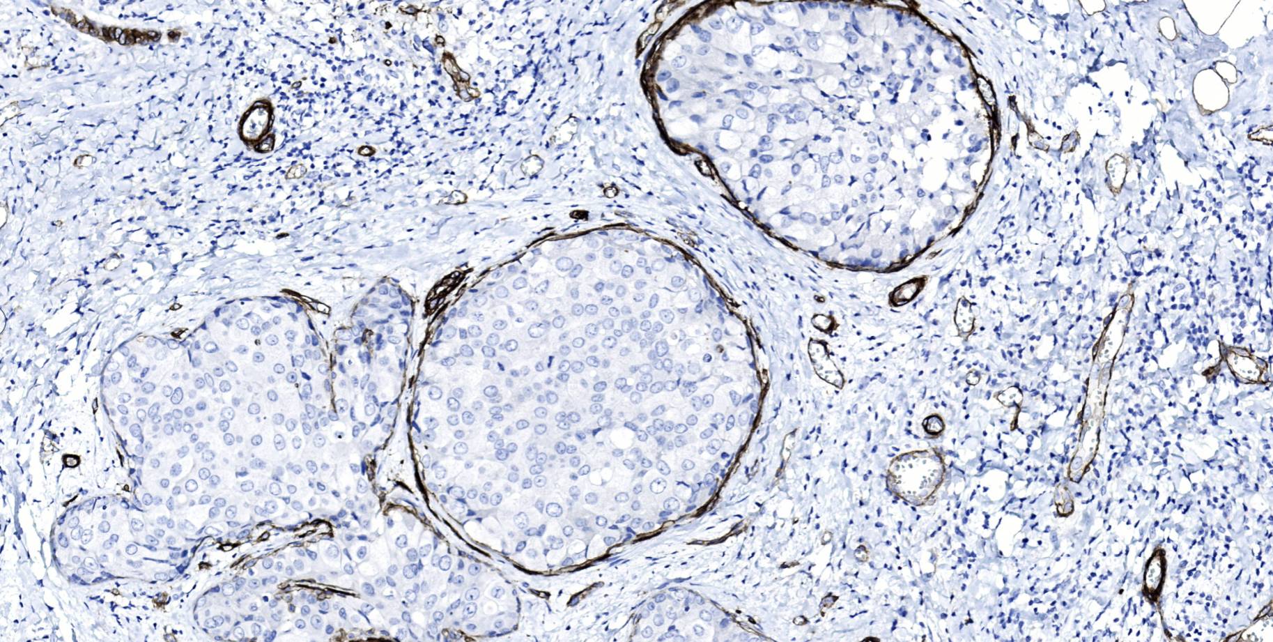 14 - CD146 AD80584