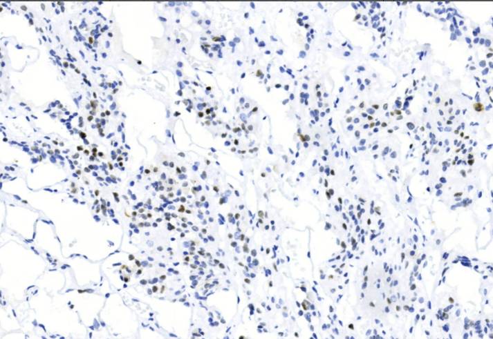 14 - PIT-1 AD80587