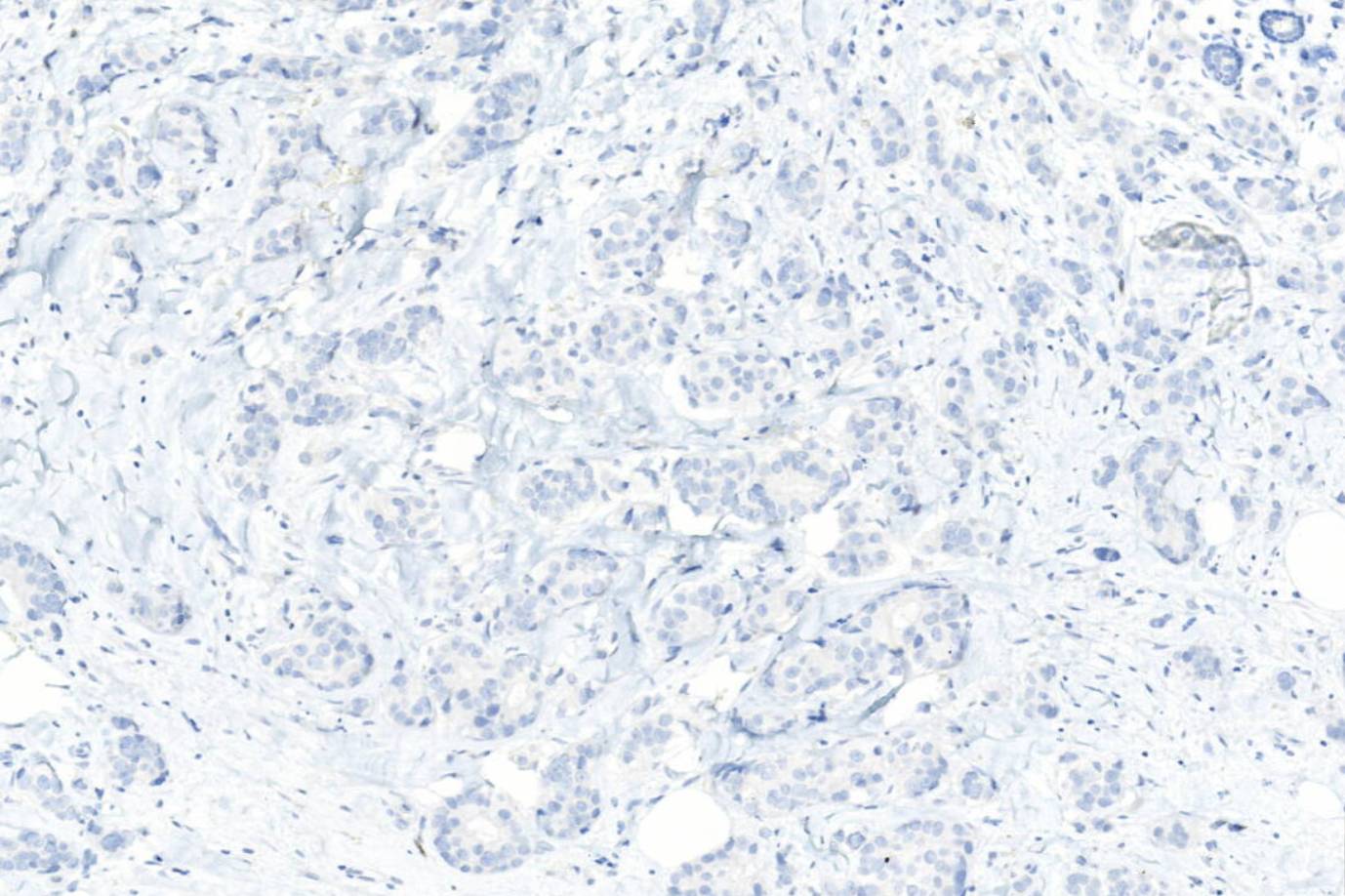 14 - HIF-1α AD80609
