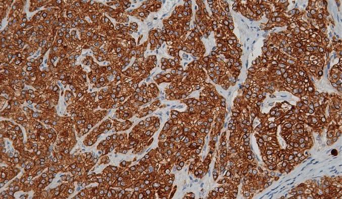 0 - CK16 antibody AD81524