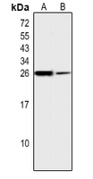 1 - Anti-EEF1B2 Antibody AP50716