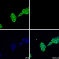 3 - Anti-FABP1 Antibody AP50718