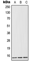1 - Anti-FABP1 Antibody AP50718