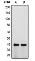 1 - Anti-ATP6V0D1 Antibody AP50719