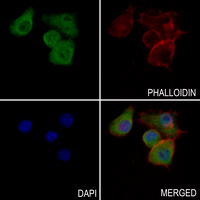 3 - Anti-ABCD3 Antibody AP50722
