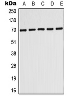 1 - Anti-ABCD3 Antibody AP50722