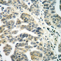 19 - Anti-RALB Antibody AP50724
