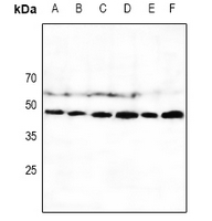 1 - Anti-CD335 Antibody AP50728