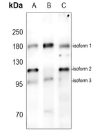 1 - Anti-ABCA5 Antibody AP50730