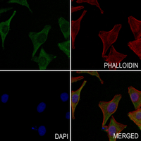 3 - Anti-G18 Antibody AP50938