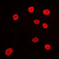 3 - Anti-Histone Deacetylase 9 Antibody AP50939