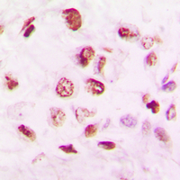 19 - Anti-Histone Deacetylase 9 Antibody AP50939