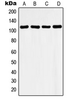 1 - Anti-Histone Deacetylase 9 Antibody AP50939