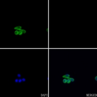 3 - Anti-Alpha 1B glycoprotein Antibody AP50942