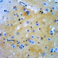 19 - Anti-Alpha 1B glycoprotein Antibody AP50942