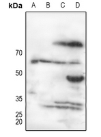 1 - Anti-Alpha 1B glycoprotein Antibody AP50942